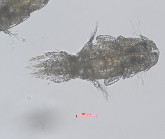 Microscopic image of a sea louse, Lepeophtheirus salmonis